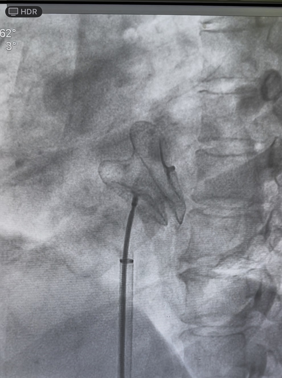 94339ac27539bb4b49f8110ea3a7329f.jpg 94339ac27539bb4b49f8110ea3a7329f.jpg