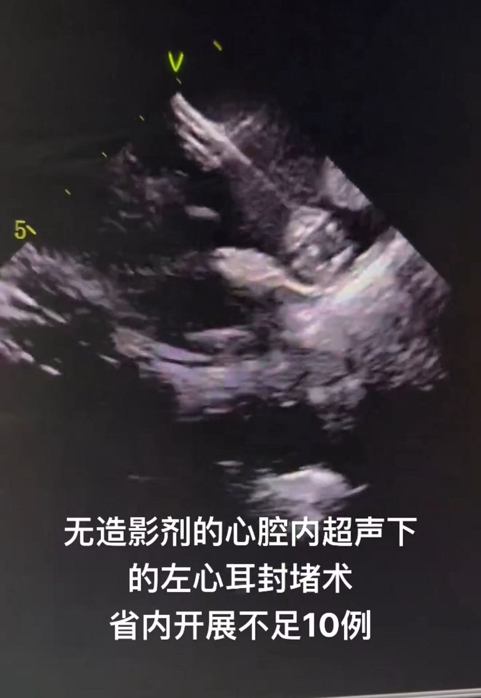 f3a26d1c988a8bb97fa4dee92c54471a.jpg f3a26d1c988a8bb97fa4dee92c54471a.jpg